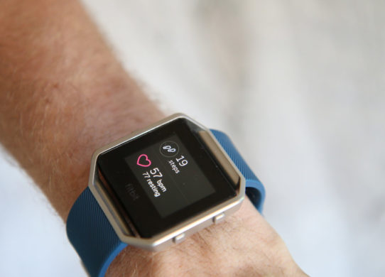 Is a Fitbit worth it?