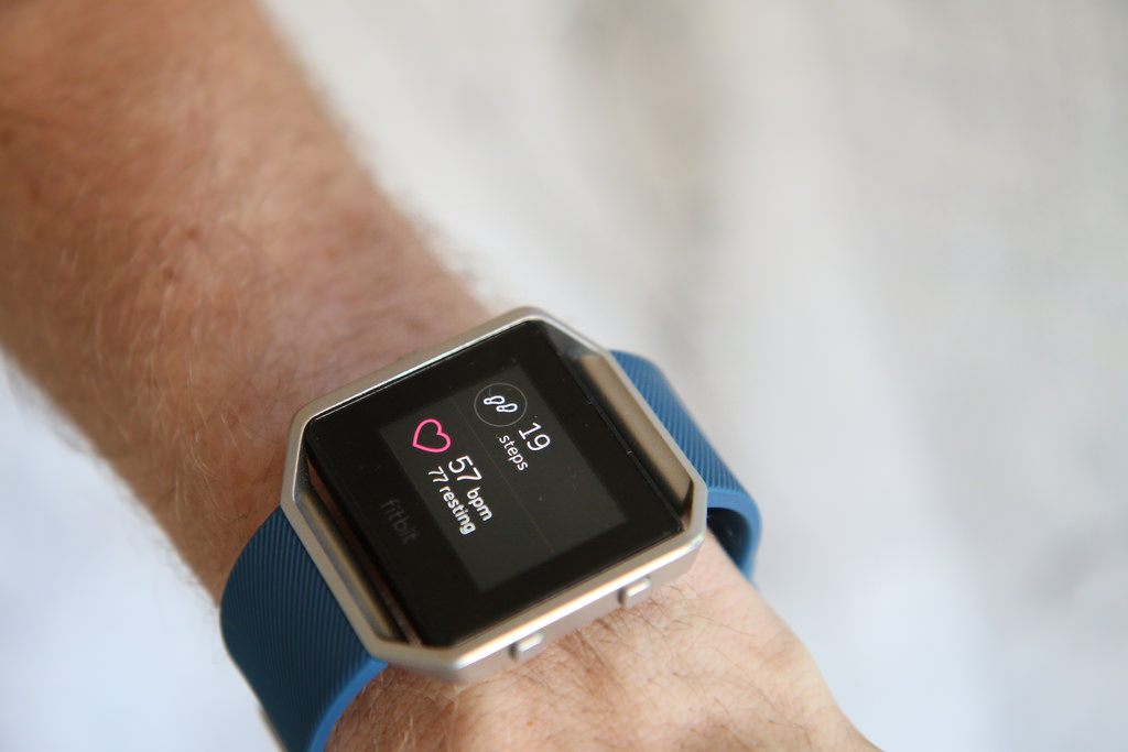 Is a Fitbit worth it?